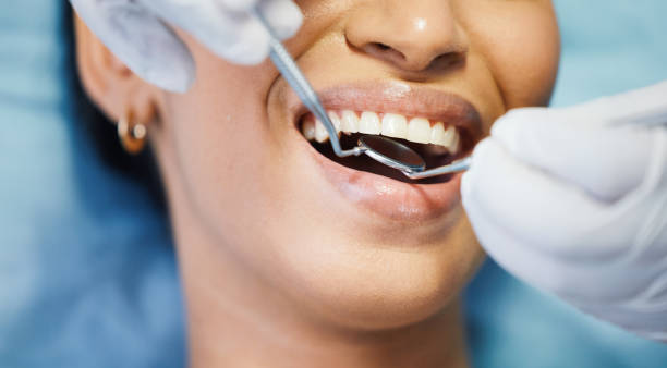 Best Emergency Dental Care for Broken or Chipped Teeth in Lindale, TX